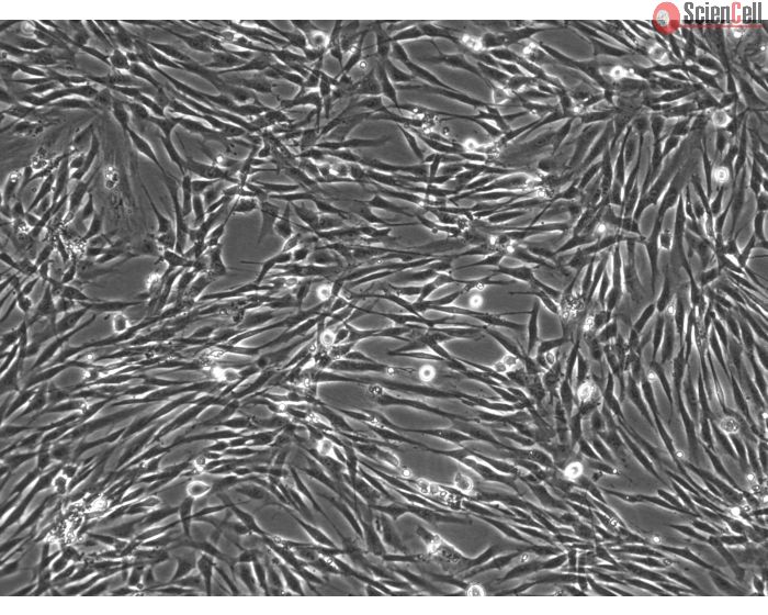 Human Seminal Vesicle Smooth Muscle Cells (HSVSMC) - Phase Contrast