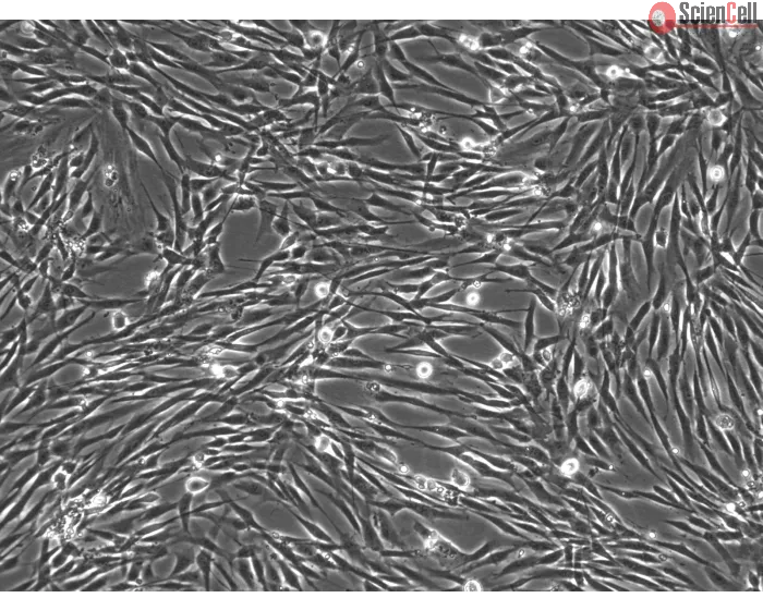 Human Seminal Vesicle Smooth Muscle Cells (HSVSMC) - Phase Contrast, 100X
