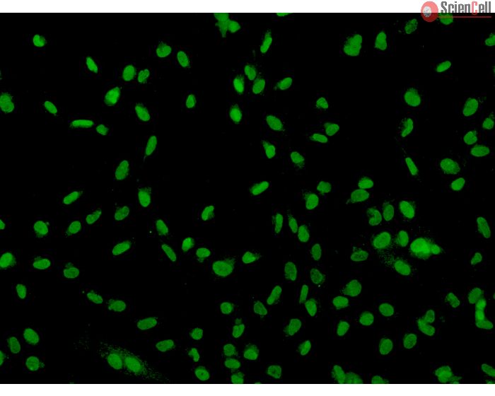 Human Sertoli Cells (HSerC)-Immunostaining for SOX-9