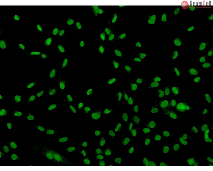 Human Sertoli Cells (HSerC)-Immunostaining for SOX-9, 200x.
