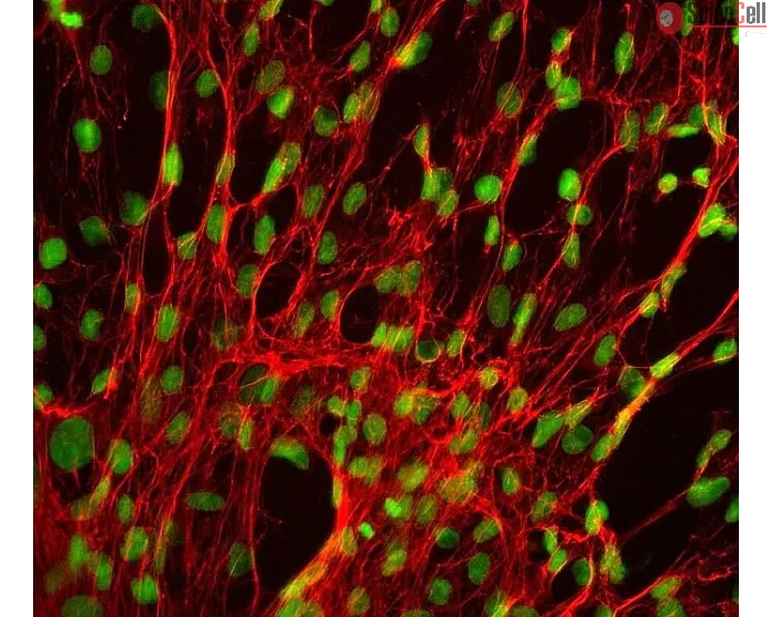 Human Splenic Fibroblasts (HSF) - Immunostaining for Fibronectin, 400x.
