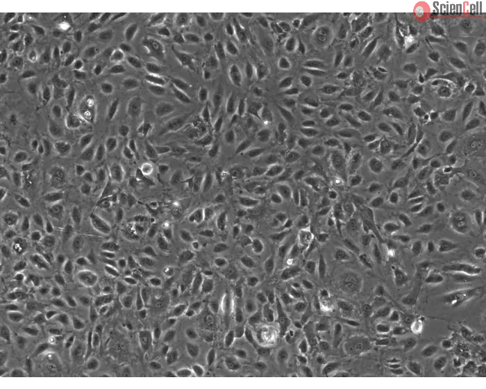 Human Testicular Endothelial Cells (HTEC)-Phase contrast, 100x.
