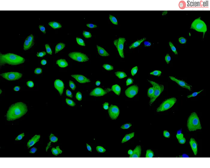 Human Thymic Epithelial Cells (HTyEpiC)-Immunostaining for Cytokeratin-18, 200x.
