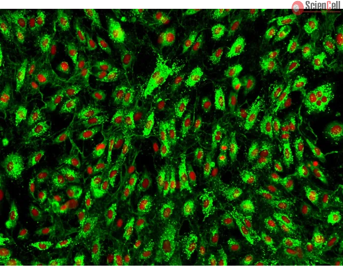 Human Tonsil Endothelial Cells (HTEC) – Immunostaining for vWF, 200x
