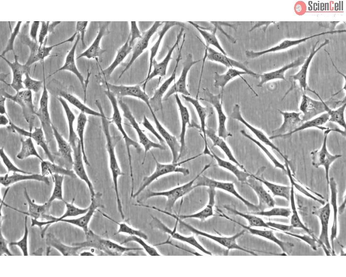 Human Trabecular Meshwork Cells (HTMC) - Phase contrast