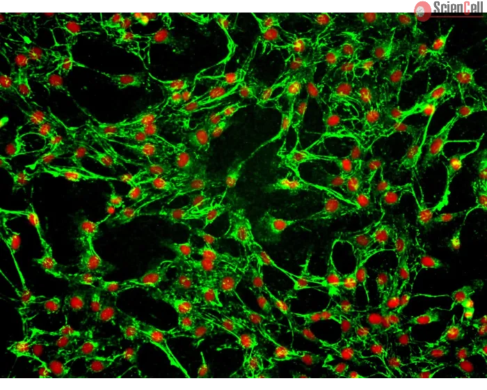 Human Tracheal Fibroblasts (HTrF) – Immunostaining for FN, 200x
