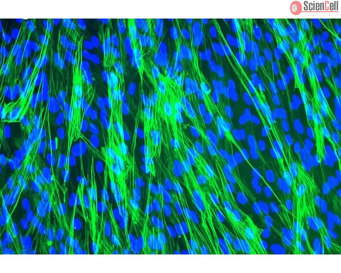 Human Tracheal Smooth Muscle Cells (HTSMC) - Immunostaining for .
