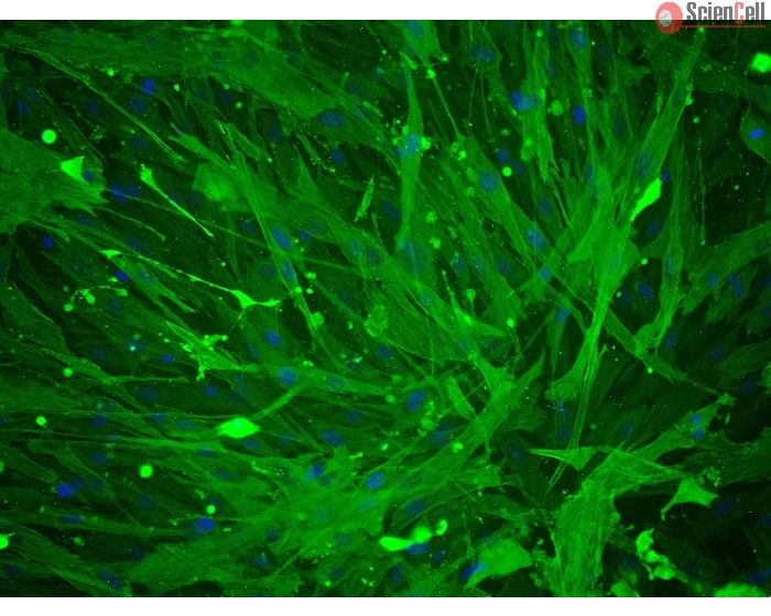 Human Umbillical Artery Smooth Muscle Cells (HUASMC) - Immunostaining for &alpha;-SMA