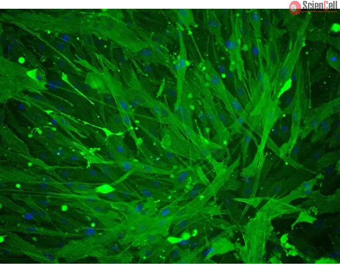 Human Umbillical Artery Smooth Muscle Cells (HUASMC) - Immunostaining for α-SMA, 200x.
