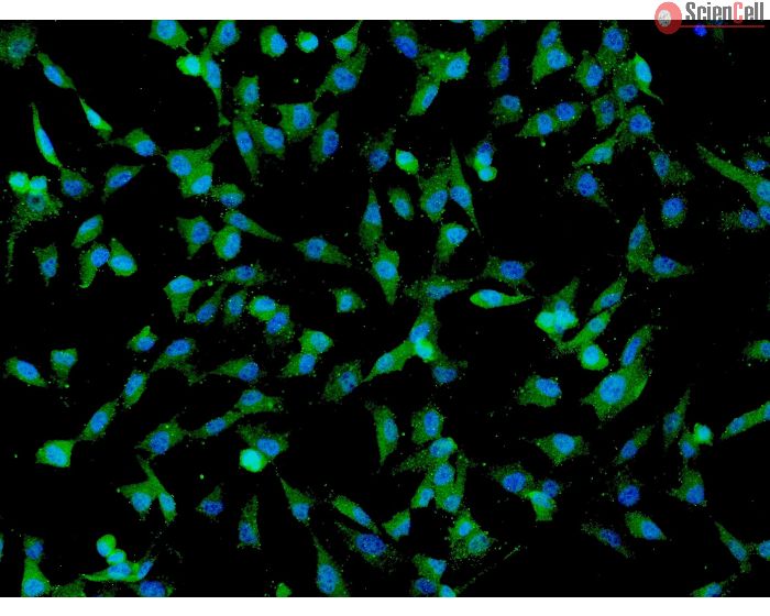 Human Umbilical Mesenchymal Stem Cells (HUMSC) - Immunostaining for CD73