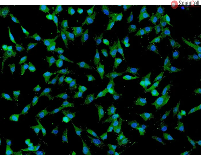 Human Umbilical Mesenchymal Stem Cells (HUMSC) - Immunostaining for CD73, 200x.
