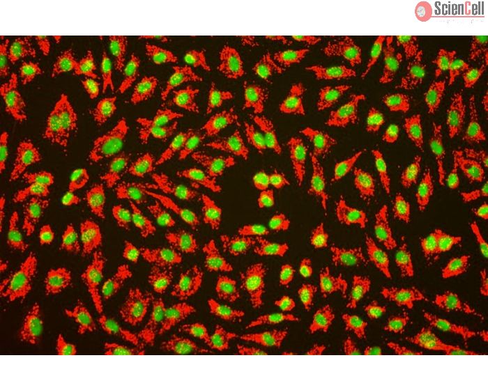 Human Umbilical Vein Endothelial Cells (HUVEC) - Immunofluorescence for Factor VIII (Sigma-Aldrich Cat.#F3520)