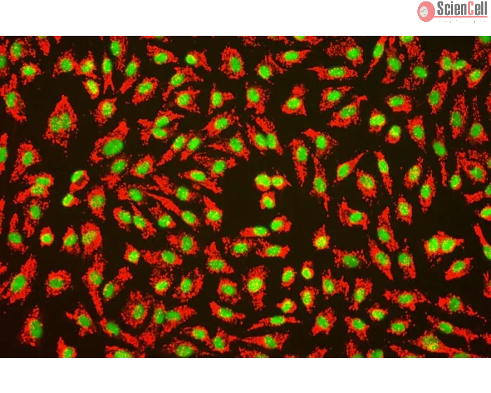 Human Umbilical Vein Endothelial Cells (HUVEC) – Immunofluorescence for vWF (Sigma-Aldrich Cat.#F3520), 200x.
