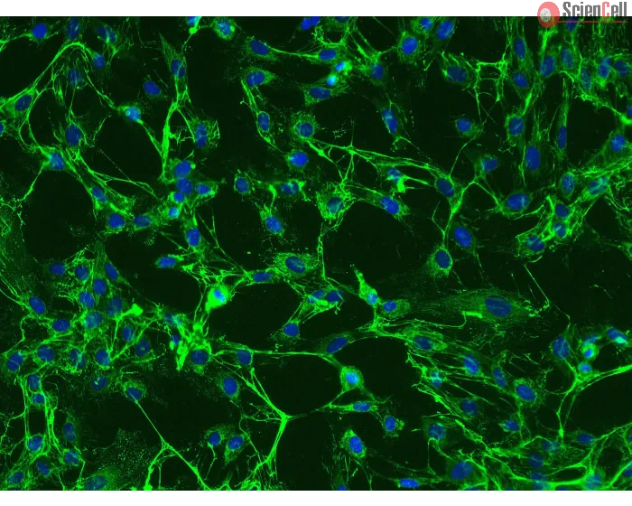 Human Uterine Fibroblasts (HUF)-Immunostaining for Fibronectin, 200x.
