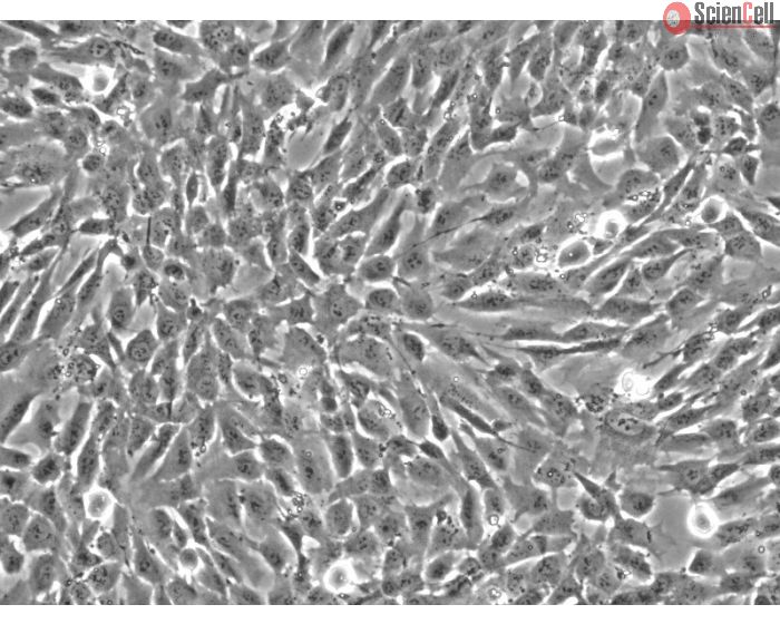 Human Vertebral Mesenchymal Stem Cells (HVMSC) - Phase contrast
