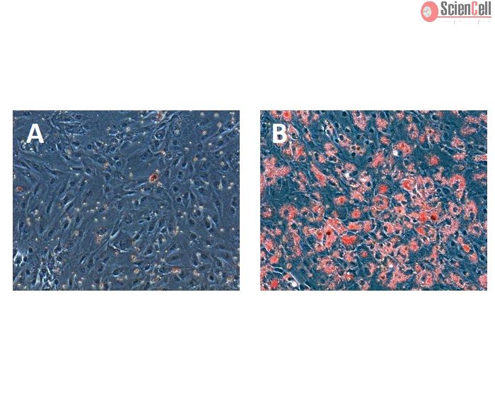 Hepatocytes were either left untreated (A) or treated with 200 μM oleic acid (B). The treated cells exhibited a significant accumulation of lipid droplets, as evidenced by the abundant presence of red dots observed through Oil Red O staining(B).
