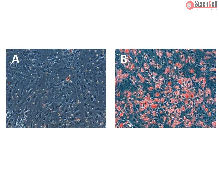 Hepatocytes were either left untreated (A) or treated with 200 μM oleic acid (B). The treated cells exhibited a significant accumulation of lipid droplets, as evidenced by the abundant presence of red dots observed through Oil Red O staining(B).