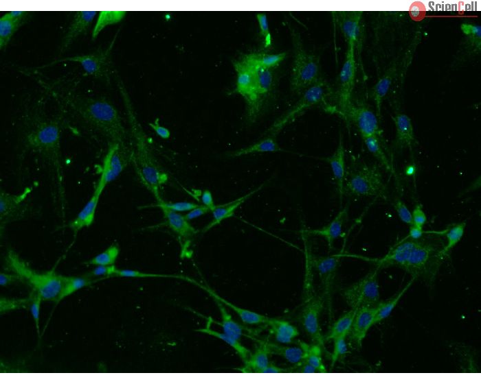 Mouse Astrocytes-adult (MA-a) – Immunostaining for GFAP