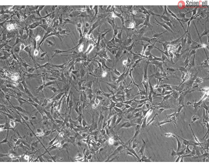 Mouse Astrocytes-cerebellar (MA-c) - Phase contrast, 100x.
