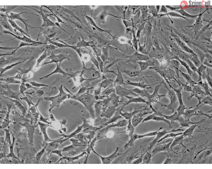 Mouse Astrocytes-cerebellar (MA-c) - Phase contrast