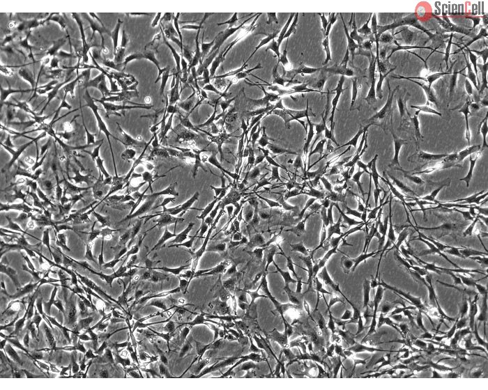 Mouse Astrocytes (MA) - Phase contrast