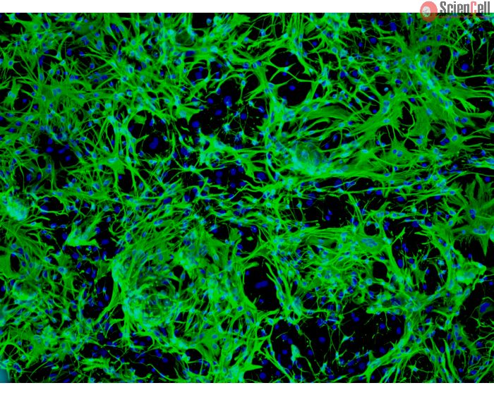 Mouse Astrocytes-midbrain (MA-mb) - Immunostaining for GFAP