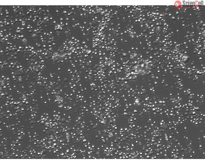 Mouse Bone Marrow Mononuclear Cells (MBMMC) – Relief Contrast, 200x
