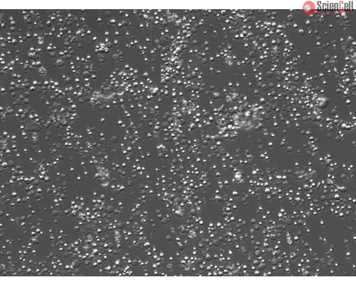 Mouse Bone Marrow Mononuclear Cells (MBMMC) – Relief Contrast, 200x
