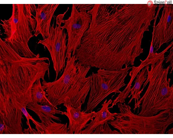 Mouse Brain Vascular Pericytes (MBVP) - Immunostaining for α-sma, 200x
