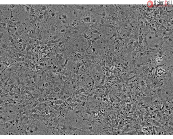Mouse Cardiac Myocytes (MCF) - Phase contrast