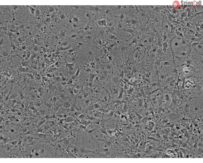 Mouse Cardiac Myocytes (MCF) - Phase contrast, 100x.
