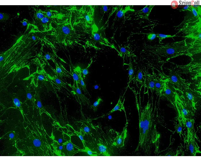 Mouse Cardiac Fibroblasts (MCF) - Immunostaining for Fibronectin, 200x.