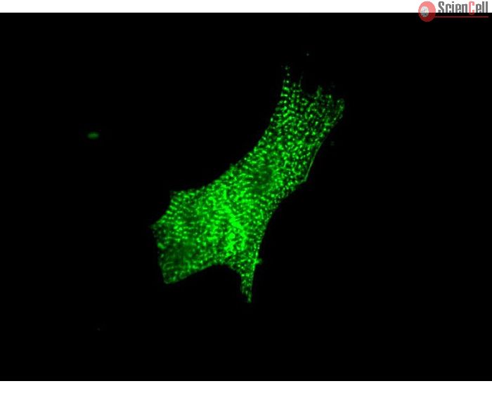 Mouse Cardiac Myocytes (MCM) – Immunostaining for Sarcomeric alpha-Actinin (Boster, Cat #MA1104)
