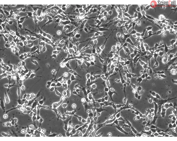 Mouse Cerebellar Granule Cells (MGC) - Phase contrast, 200x.
