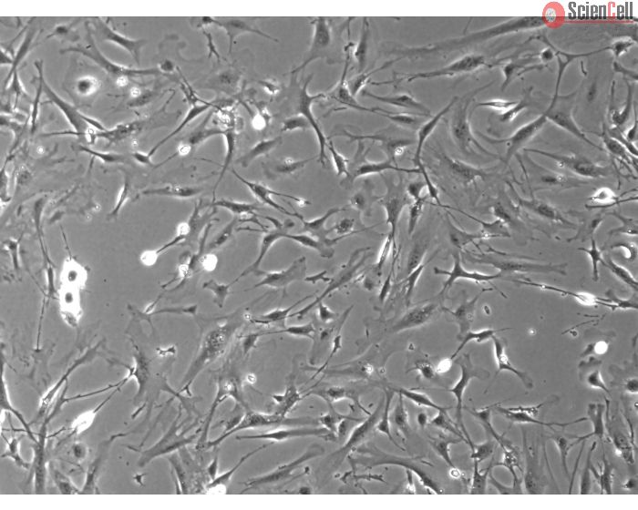 Mouse Dermal Fibroblasts (MDF) - Phase Contrast