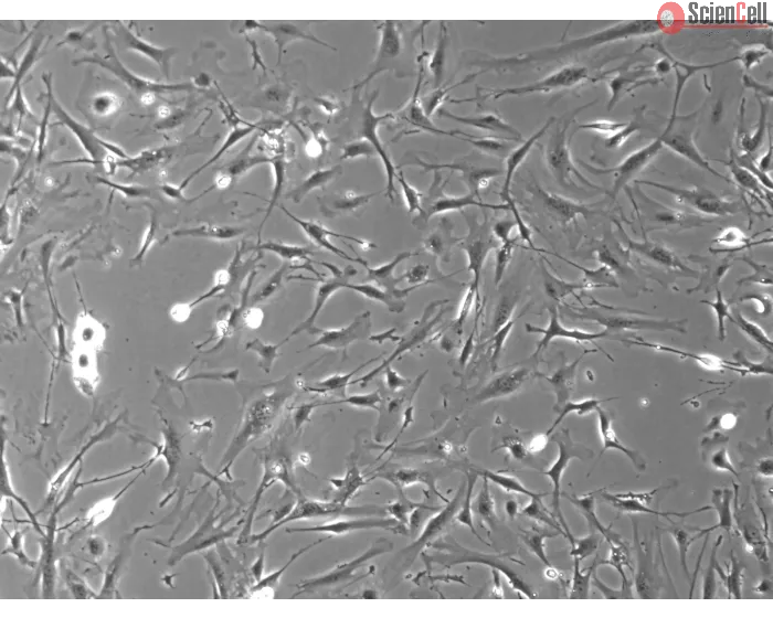 Mouse Dermal Fibroblasts (MDF) – Phase Contrast, 100x.