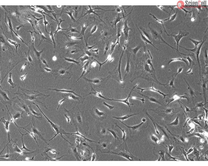 Mouse Dermal Fibroblasts (MDF)- Phase Contrast, 100x
