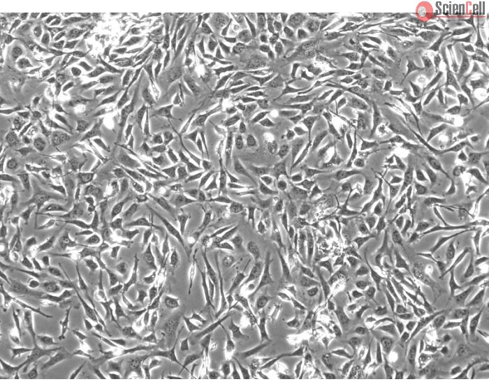 Mouse Embryonic Fibroblasts (MEF) - Phase contrast, 100x.
