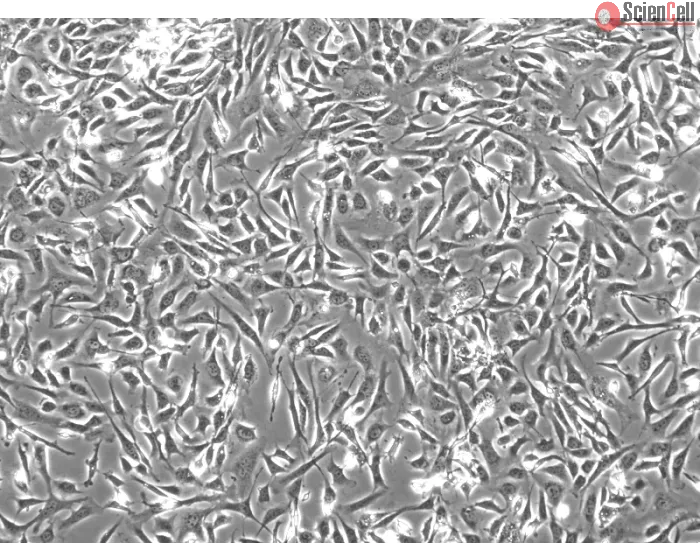 Mouse Embryonic Fibroblasts (MEF) - Phase contrast, 100x.
