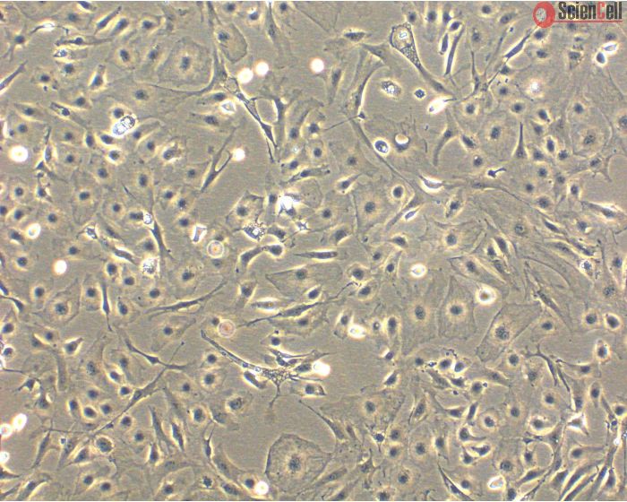 Mouse Hepatic Mesothelial Cells (MHMeC) - Phase Contrast, 100x