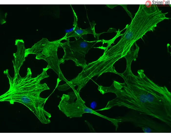 Mouse Hepatic Stellate Cells (MHSteC) – Immunostaining for α-sma, 200x
