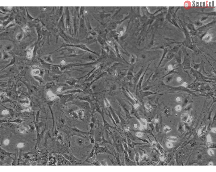 Mouse Hepatic Stellate Cells (MHSteC) - Phase contrast, 100x.
