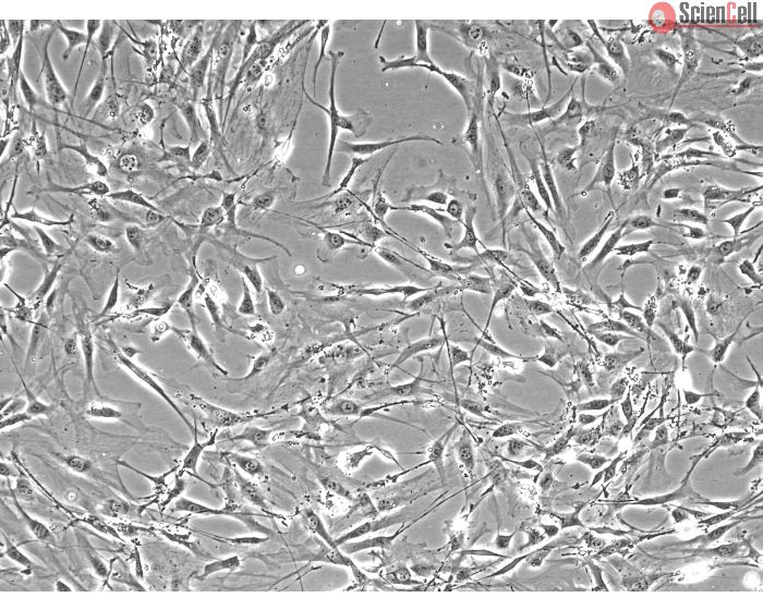 Mouse Lymphatic Fibroblasts (MLF) - Phase Contrast