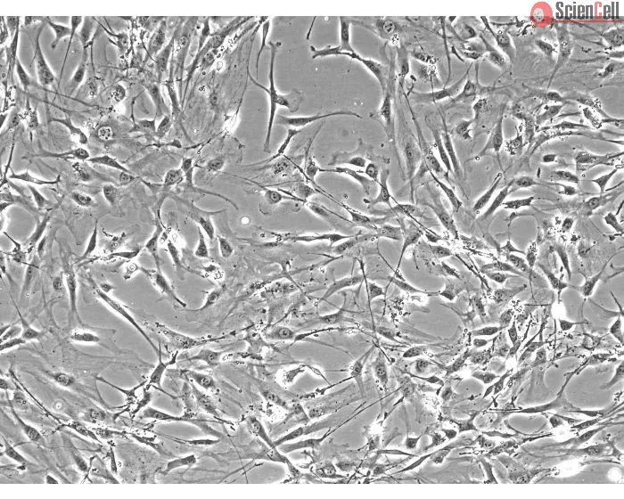 Mouse Lymphatic Fibroblasts (MLF) – Phase Contrast, 100x
