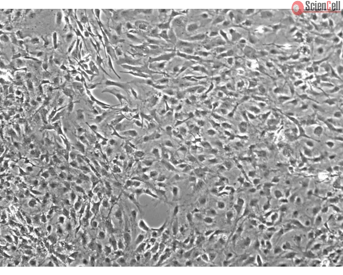 Mouse Meningeal Cells (MMenC) - Phase contrast, 100x.
