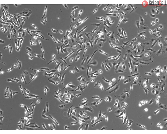 Phase Contrast Caption: Mouse Microglia (MM)- Phase Contrast, 100x
