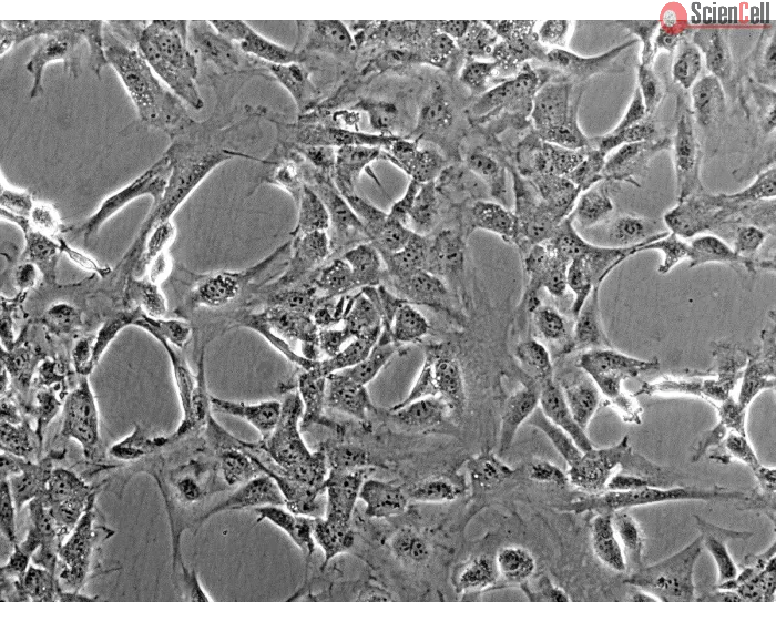 Mouse Meningeal Cells (MMenC) - Phase contrast, 200x.
