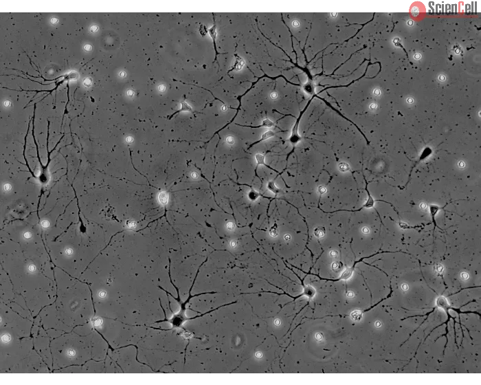 Mouse Neurons-spinal cord (MN-sc) - Phase contrast, 200x.
