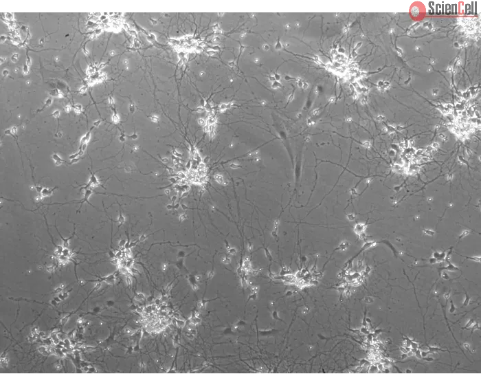 Mouse Neurons-striatal (MN-s) - Phase Contrast, 100x