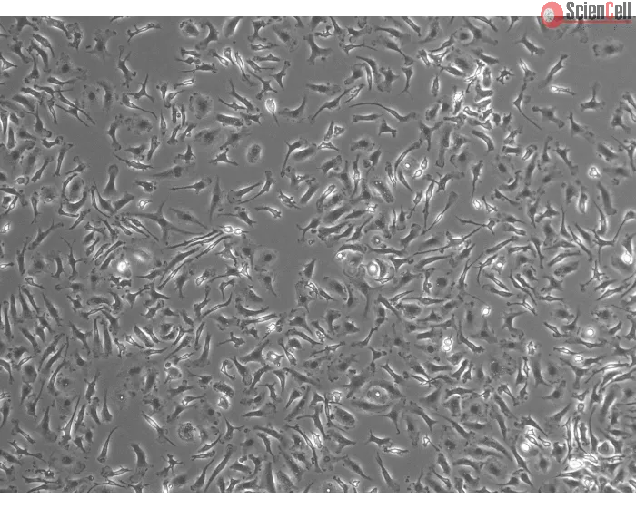 Mouse Pulmonary Alveolar Macrophages (MPAMa) - Phase contrast, 100x
